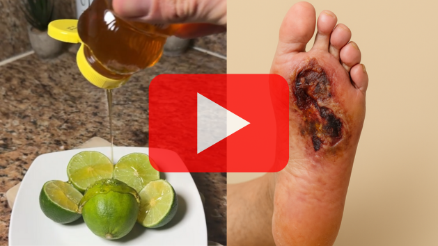 Watch the discovery video